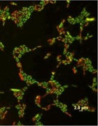 ����� �� ����������� � ��������� ��������� ��������?