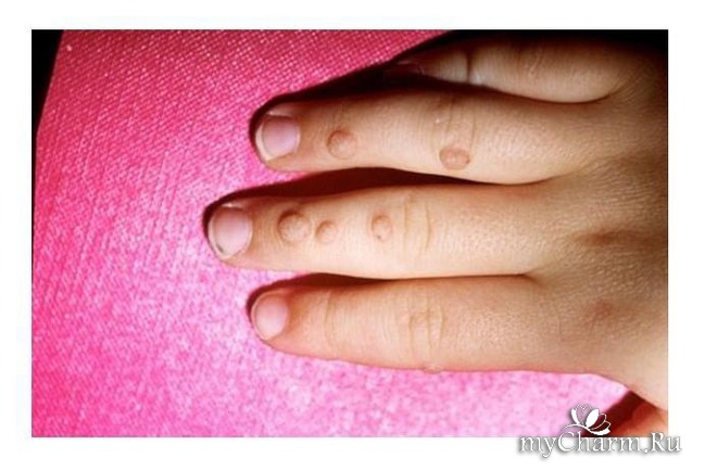 Заболевания кожи рук и ногтей 48