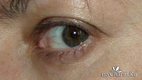 Биокон крем актив для кожи вокруг глаз отзывы