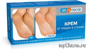 "  " /               F