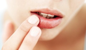Народные рецепты лечения герпеса на губах
