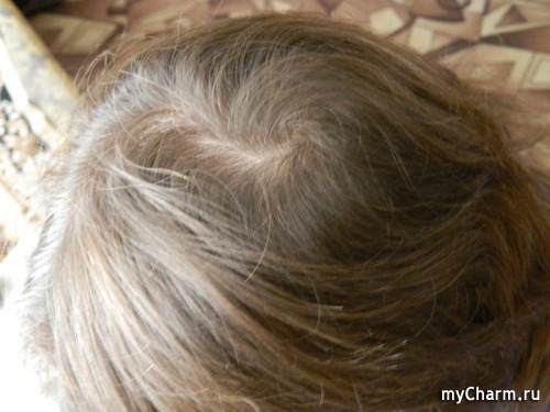 Комплекс для волос для укрепления и роста волос аптечка агафьи