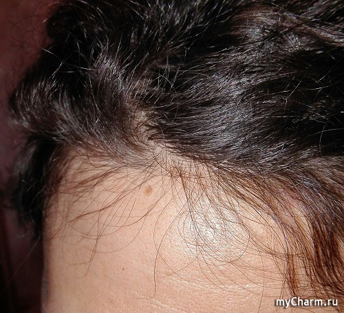 Dnc стимулятор роста для улучшения структуры волос