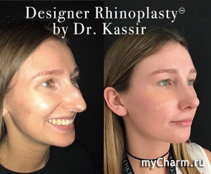 ������������: �� � ������